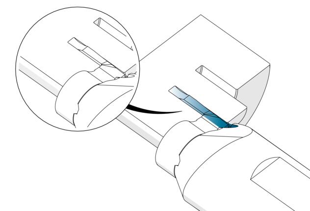 Su ingombro